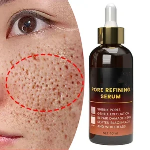 Facial serum to enlarge pores, remove blackheads, and control oil